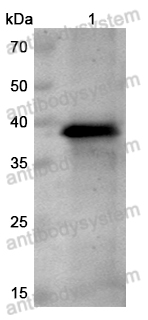 Anti-Monkeypox virus/MPXV A44R Polyclonal Antibody